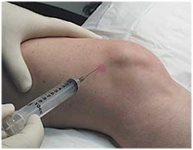 injection-(1).jpg